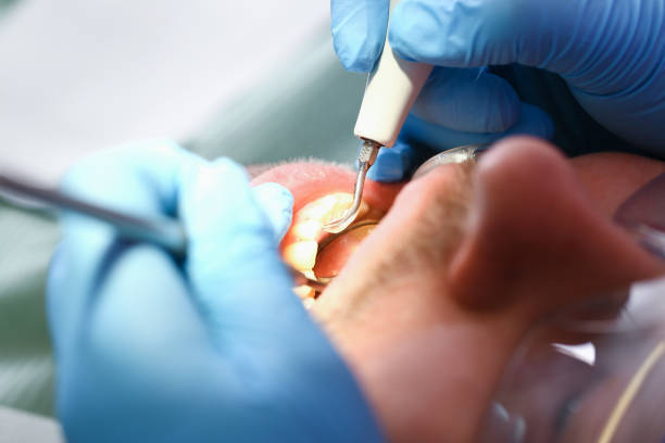 Best Emergency Dental Care for Abscessed Tooth in East Riverdale, MD