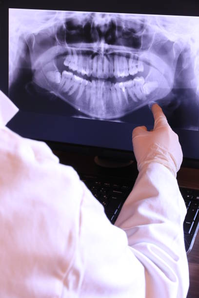 Best Emergency Root Canal Treatment in East Riverdale, MD