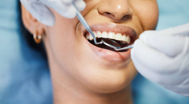 Best Emergency Root Canal Treatment in East Riverdale, MD