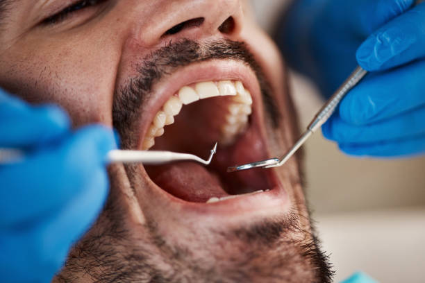 Best Emergency Cosmetic Dentistry in East Riverdale, MD