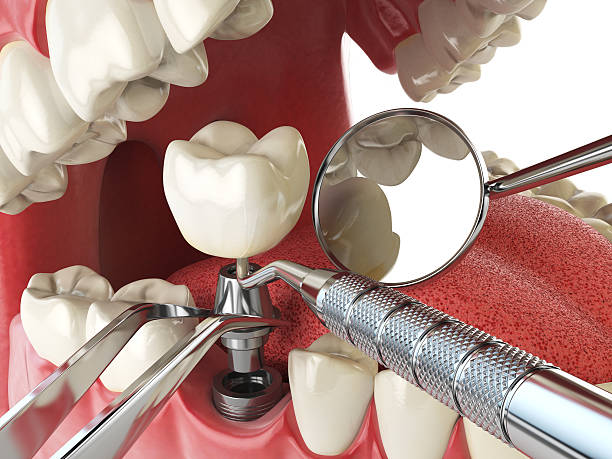 Best Urgent Dental Care for Toothache in East Riverdale, MD